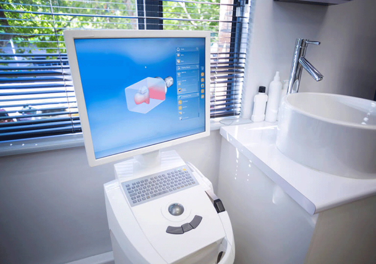 Itero scanner